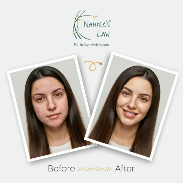 Before and after comparison of a woman’s skin using Nature’s Law skincare – from acne-prone and dull to clear, smooth, and glowing.