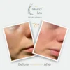 Nature’s Law Skin Glow Serum before and after results – smoother, brighter skin
