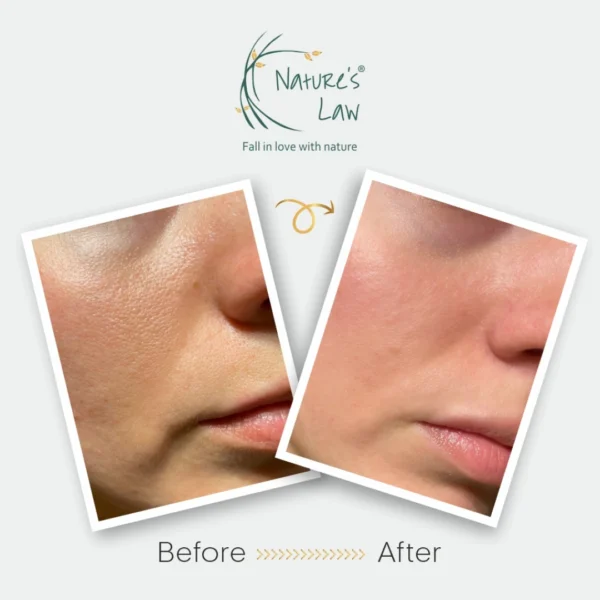 Nature’s Law Skin Glow Serum before and after results – smoother, brighter skin